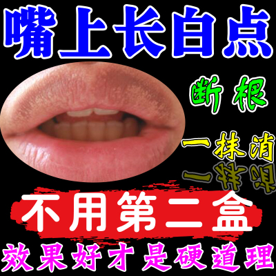 嘴唇皮脂腺异位嘴唇干裂脱皮药膏