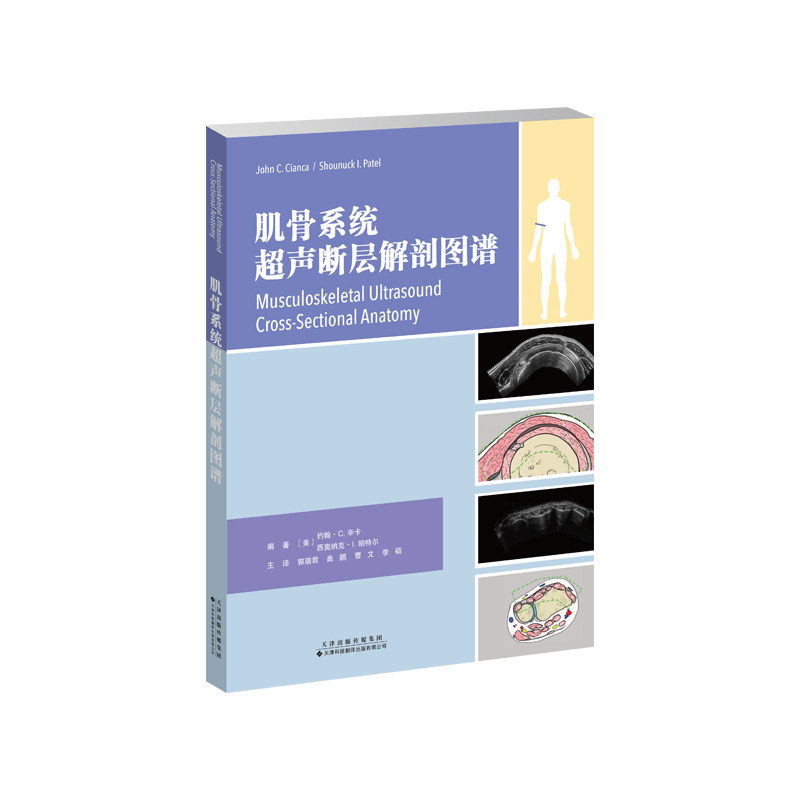 肌骨系统超声断层解剖图谱 编著：约翰·C. 辛卡（美），西奥纳克·I. 帕特尔(美) 9787543342170