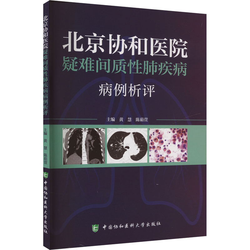北京协和医院疑难间质性肺疾病病例析评 主编黄慧, 陈茹萱 9787567924567
