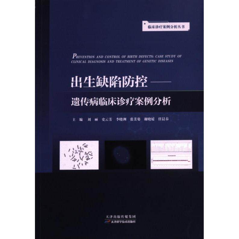 出生缺陷防控 刘丽, 史云芳, 李晓洲等主编 9787574206755