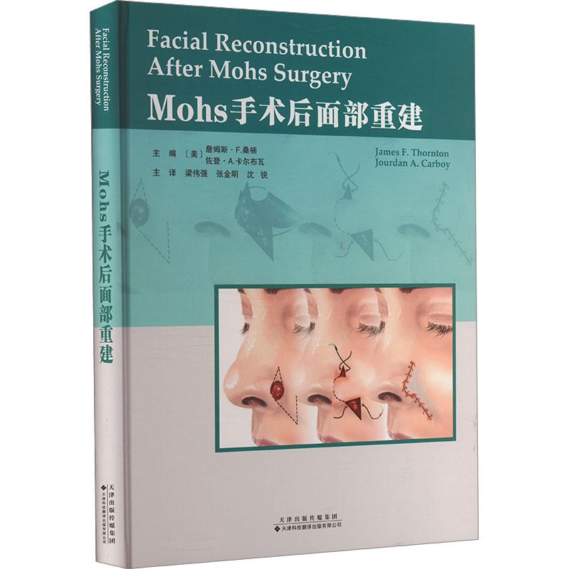 Mohs手术后面部重建 主编 (美) 詹姆斯·F. 桑顿, 佐登·A. 卡尔布瓦 9787543344464