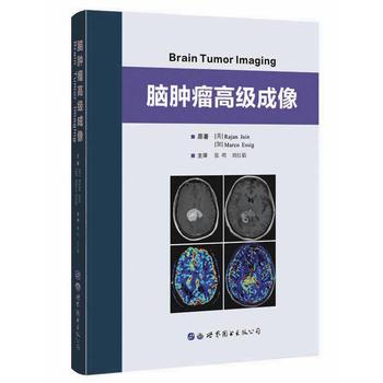 脑肿瘤高级成像 Raian Jain    Marco Essig 世界图书出版公司