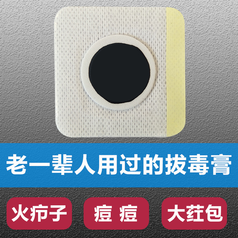 拔毒膏拔毒贴火疖子柳条膏古法传统拔脓膏吸脓贴黑膏贴冀明盛