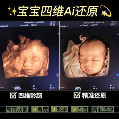 宝宝四维ai照片彩超还原深度预测胎儿长相模样三五维婴儿高清成像