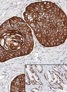 PV-8000 二步法通用试剂盒