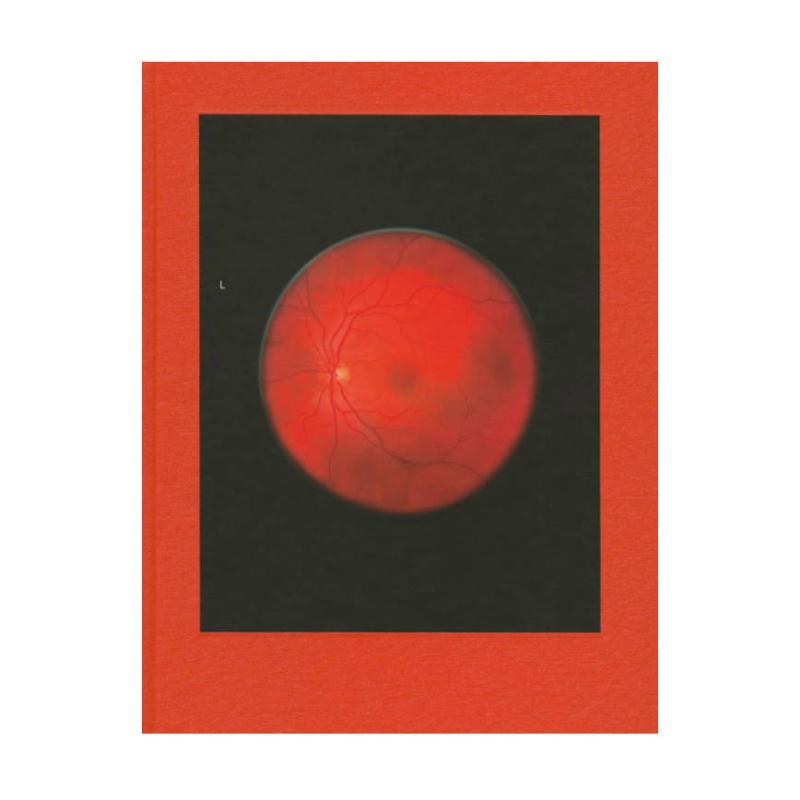 预售 Michael Subotzky: Retinal Shift米哈伊尔苏博斯基：视网膜转移