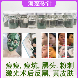 海藻矽针植物海绵微针焕肤骨针祛痘坑粉刺祛痘淡化暗斑美容院专用