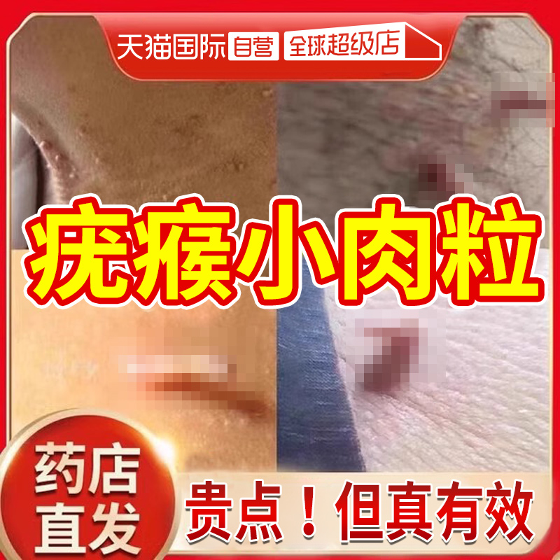 【自营】扁平疣瘊子软膏去疣痰小肉粒扁平疣去除一抹灵神器肉疙瘩