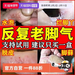 脚气止痒脱皮杀菌真菌感染专用喷雾药膏特效烂脚丫药脱皮糜烂脚趾