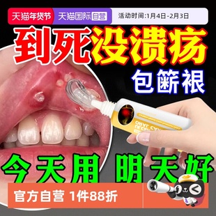口腔溃疡专用药特效药一点灵药膏贴西瓜霜舌头溃疡灵口疮