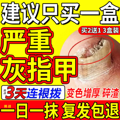 【自营】灰指甲特效药根治第一名专用药正品官方旗舰店亮治疗灰甲