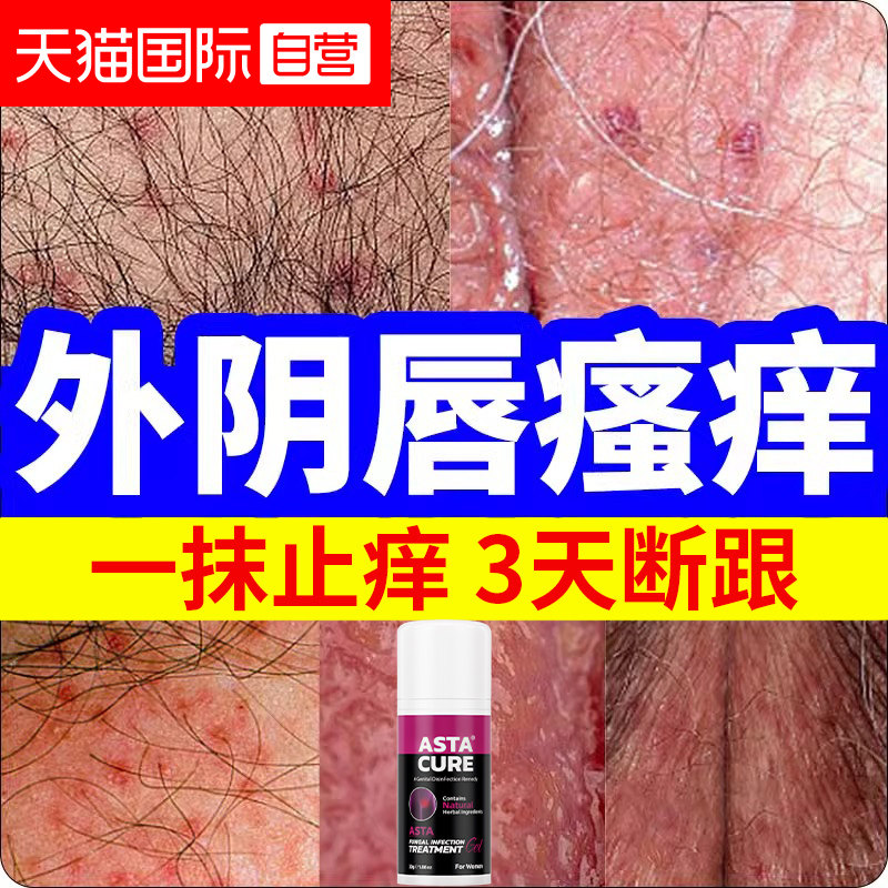 ����װ1ƿ/30g��1�܃������������ ����Ӫ����������ֹ���־����׸���ר��ҩ��ֹ����Ů˽��ʪ��ȥ��