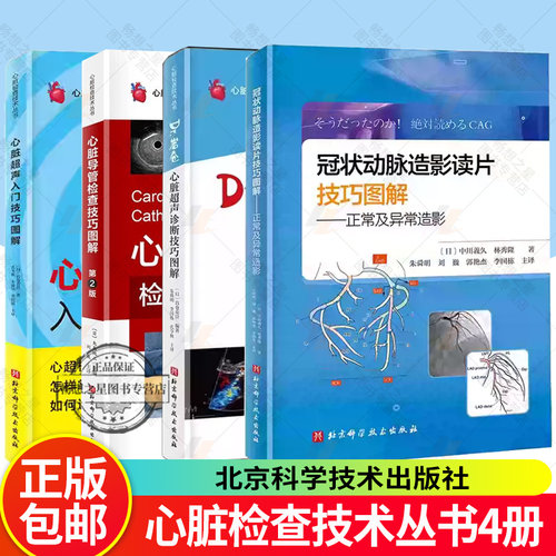 心脏检查技术丛书4册  心脏超声入门技巧图解 心脏超声诊断技巧图解  心脏导管检查技巧图解第2版  冠状动脉造影读片技巧图解