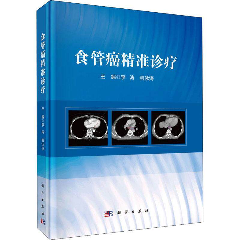 正版食管癌诊疗李涛书店医药卫生书籍 畅想畅销书