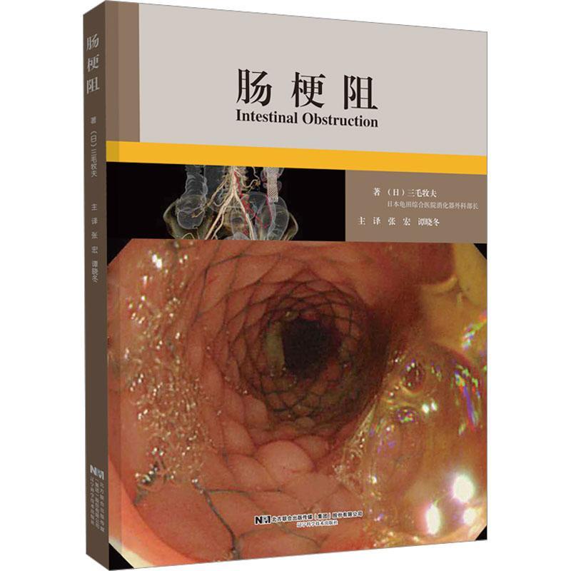 正版肠梗阻三毛牧夫书店医药卫生书籍 畅想畅销书