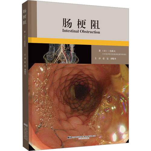 正版肠梗阻三毛牧夫书店医药卫生书籍 畅想畅销书
