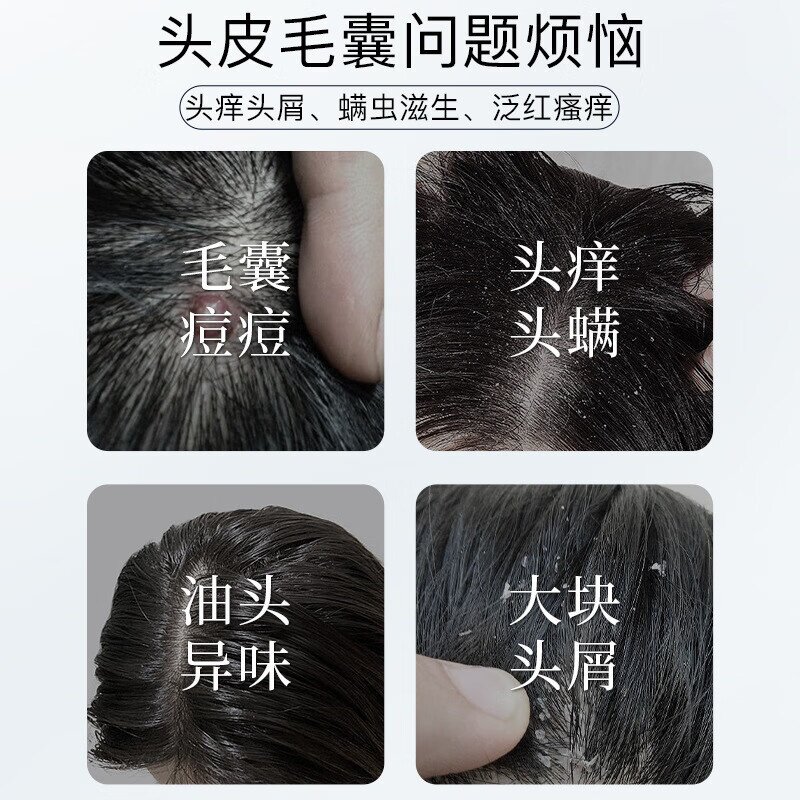 南京同仁堂毛炎氨基酸宁洗发水露修复毛囊植物除螨洗头膏厂家批发
