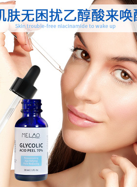Glycolic Acid Peel 70% Shrink Pores Brighten skin 乙醇酸原液