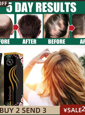 Hair Loss Treatment Fast Regrowth Essential Anti-loss Serum