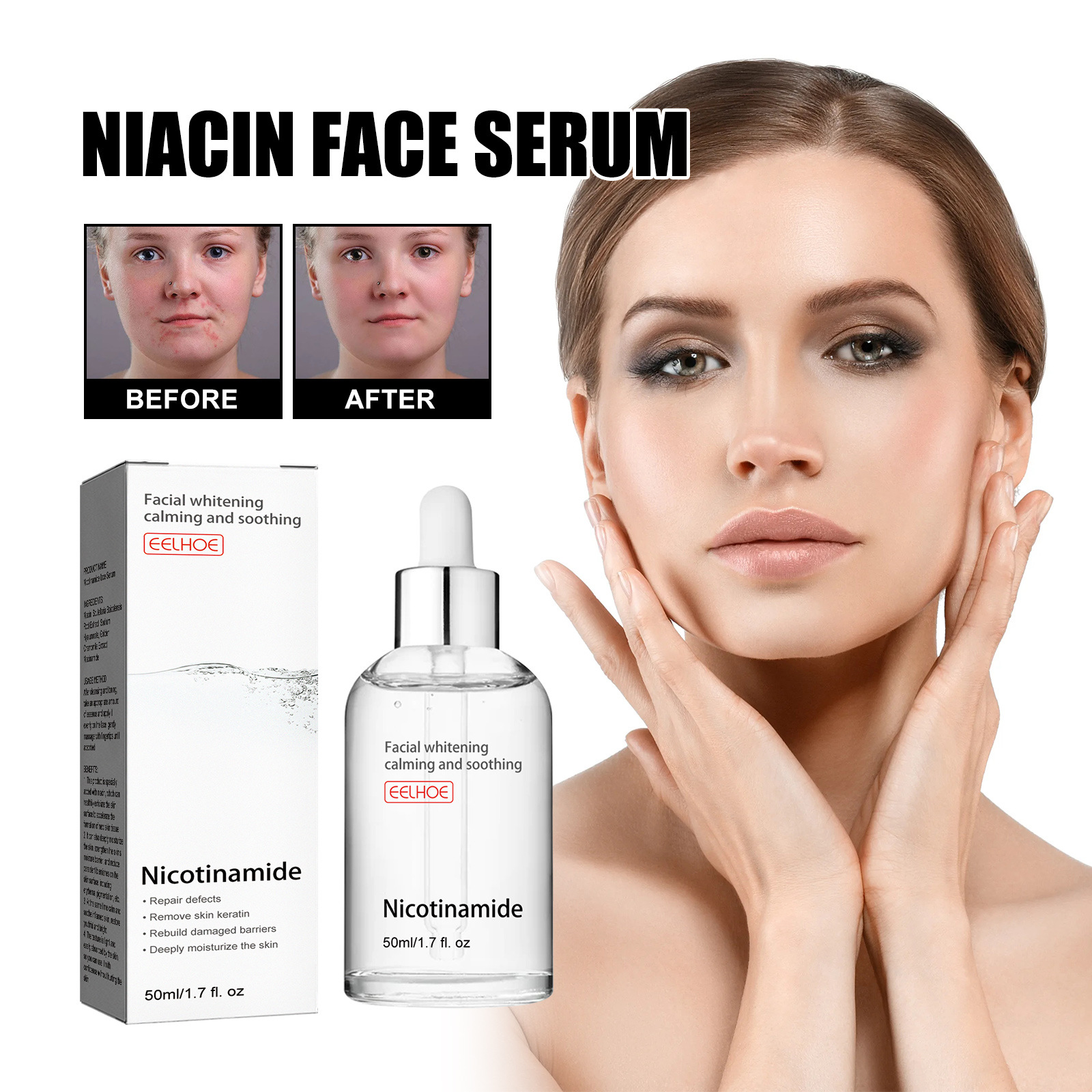 Niacin facial essence liquid moisturizes Fade acne marks 美容护肤/美体/精油 液态精华 原图主图