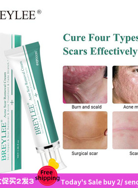 BREYLEE Remove scars Pregnant woman Stretch marks Care cream