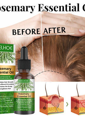 EELHOE Rosemary Serum Hair Growth Care Oil Nourishes Scalp