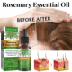 Rosemary Nourishes Serum Growth EELHOE Oil Hair Care Scalp