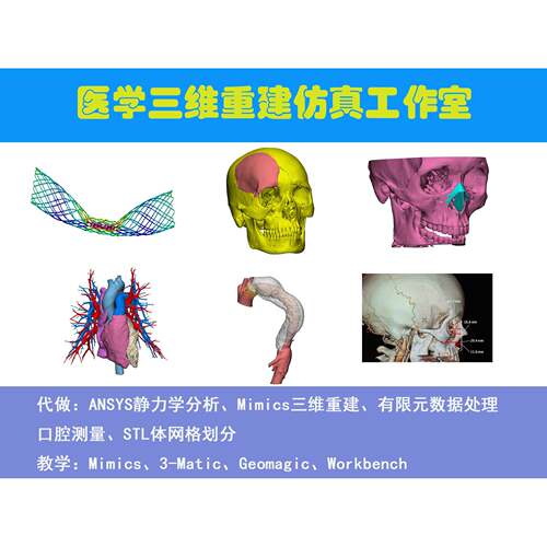 Ansys分析 Mimics代做数据测量指导 有限元数据格式转换
