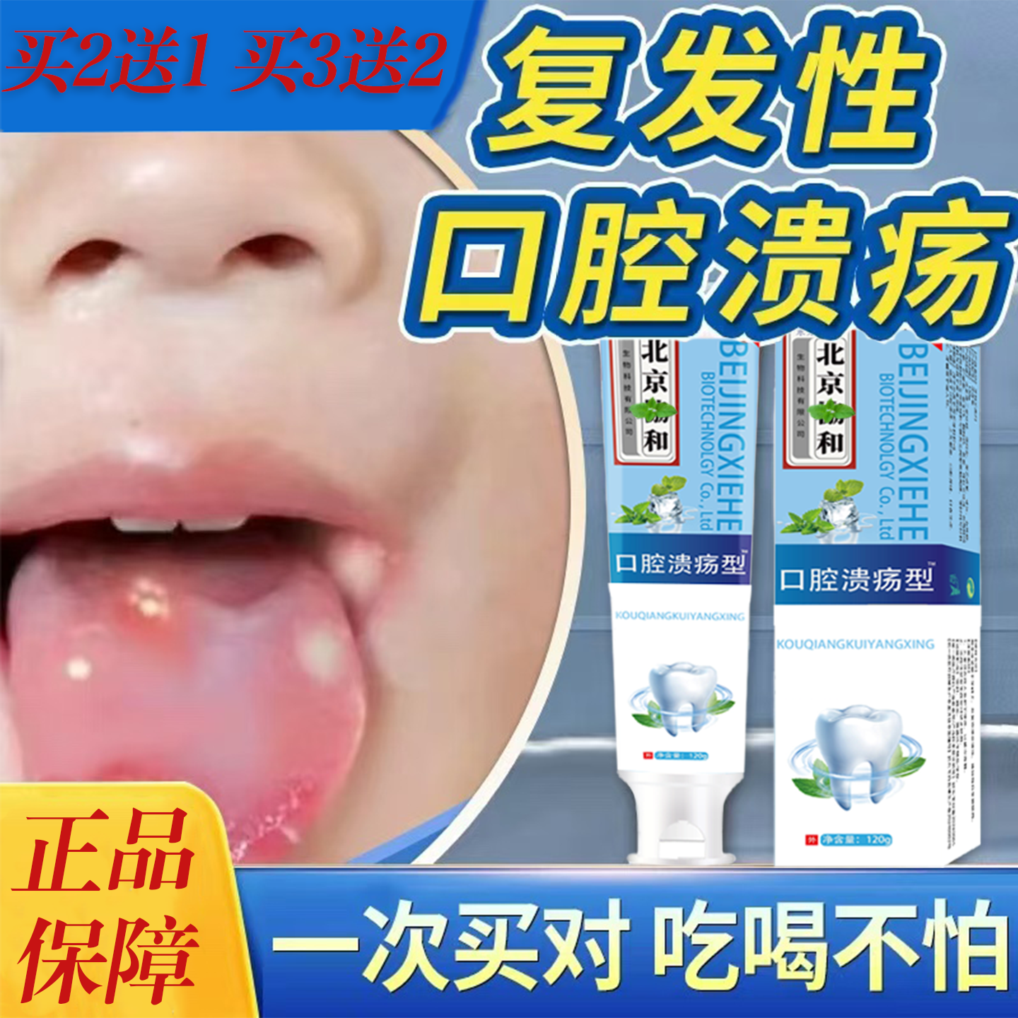 口腔溃疡专用牙膏预防口舌生疮牙龈护理牙龈上火起泡出血官方正品
