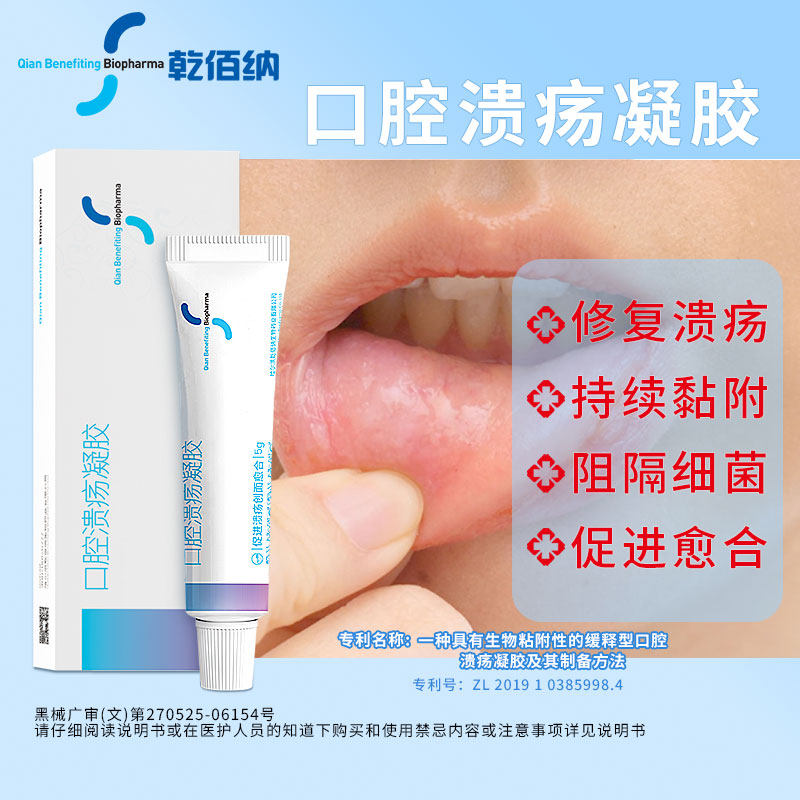 乾佰纳口腔溃疡凝胶上火牙龈肿痛复发口疮口腔炎缓解疼痛口腔护理