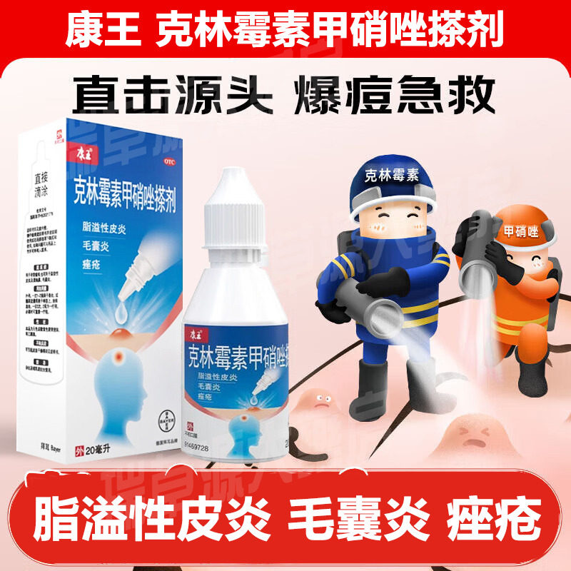 康王克林霉素甲硝唑搽剂痤疮脂溢性皮炎酒糟鼻毛囊炎非喷雾凝胶