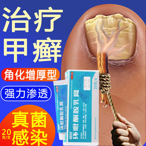 环吡酮胺乳膏正品花斑癣体廯股藓非15g软膏