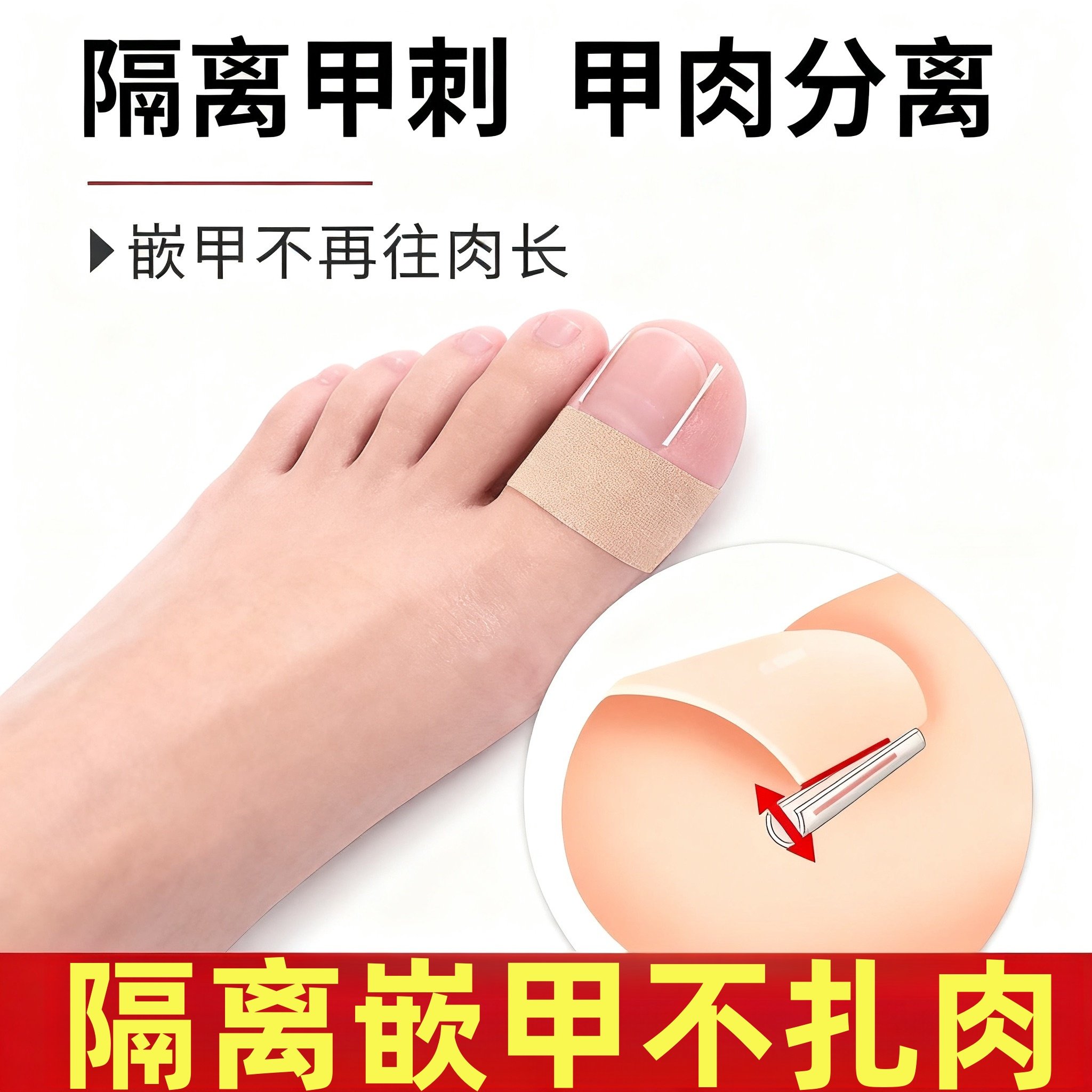 甲沟垫嵌甲填充垫片矫正器正甲贴指甲脚趾甲长肉里专用修甲刀护理