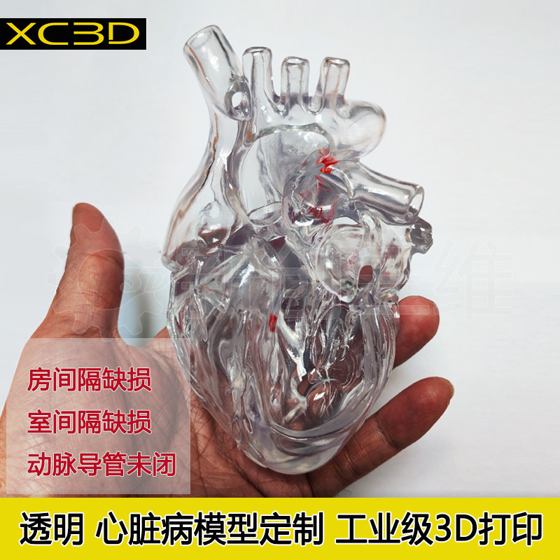 3d打印心脏病透明模型房间隔缺损动脉导管未闭医学定制教学教具