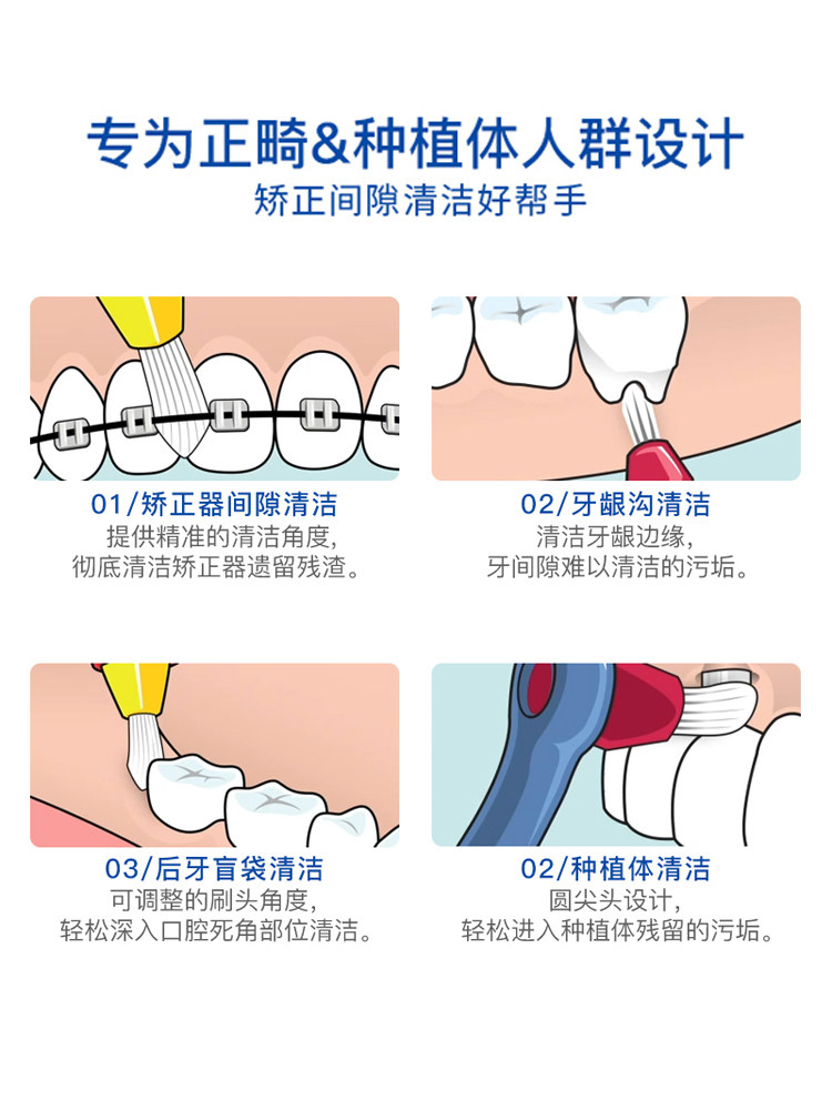 SWEDEN IMPORTED TEPE SINGLE-HEAD TOOTH GAP BRUSH BRISTLES IMPLANT ORTHODONTIC ALIGNERS SPECIAL REPLACEABLE SMALL BRUSH HEAD
