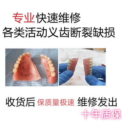 牙科活动义齿维修专业维修义齿断裂缺损钢托排牙维修破损完美修复