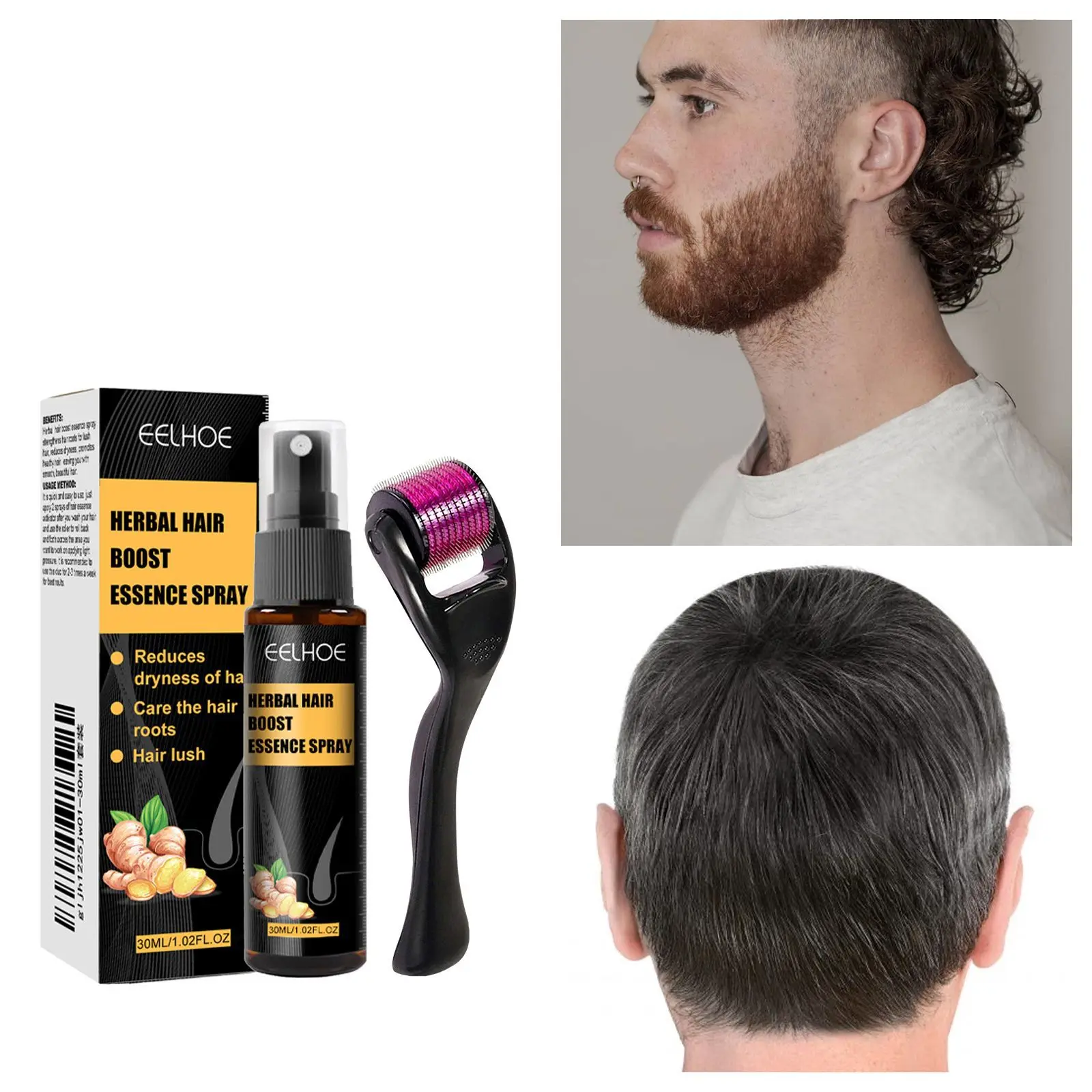 草本防掉滚轮精油防止掉落密发