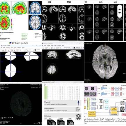 医学图像分割 分类 医疗影像分割 深度学习代做python