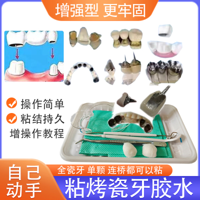 烤瓷牙粘接剂假牙粘合剂全瓷牙冠自己粘金属牙套连桥钢牙专用胶水