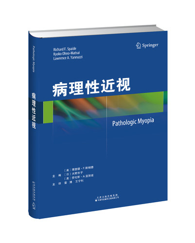 眼科 近视  病理性近视