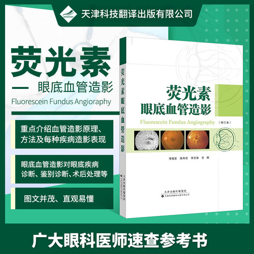 【官方直营】荧光素眼底血管造影 荧光造影 虹膜血管造影 血管造影对眼底病的诊断 视网膜血管性疾病 视神经疾病 葡萄膜炎眼内肿瘤