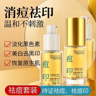 祛痘印精华液美白修复淡化去黑色素沉淀水杨酸去痘后消印红黑痘印