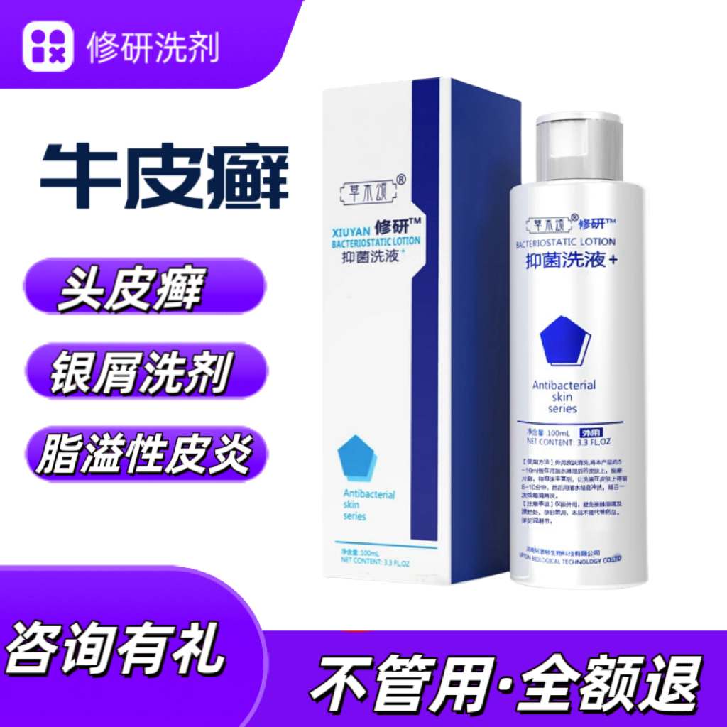 洗发水治头皮癣头部脂溢性皮炎病止痒去屑软膏头皮外用