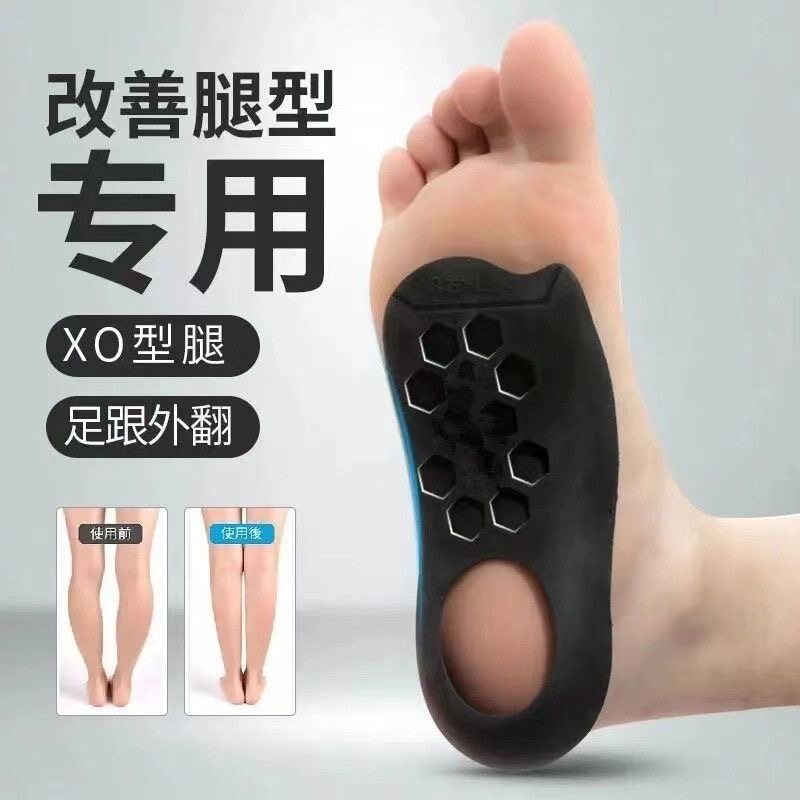 扁平足鞋垫足弓矫正足外翻内八字鞋垫