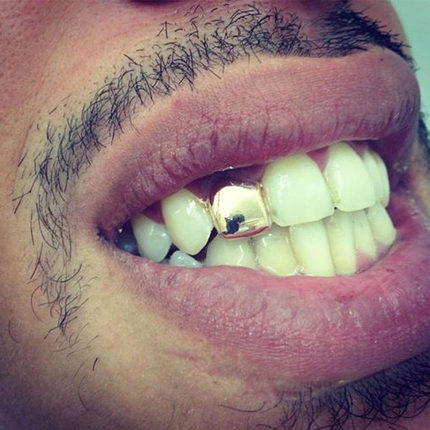 hiphop grillz金牙套嘻哈饰品单颗牙齿镶金边嘻哈牙套镂空金牙套