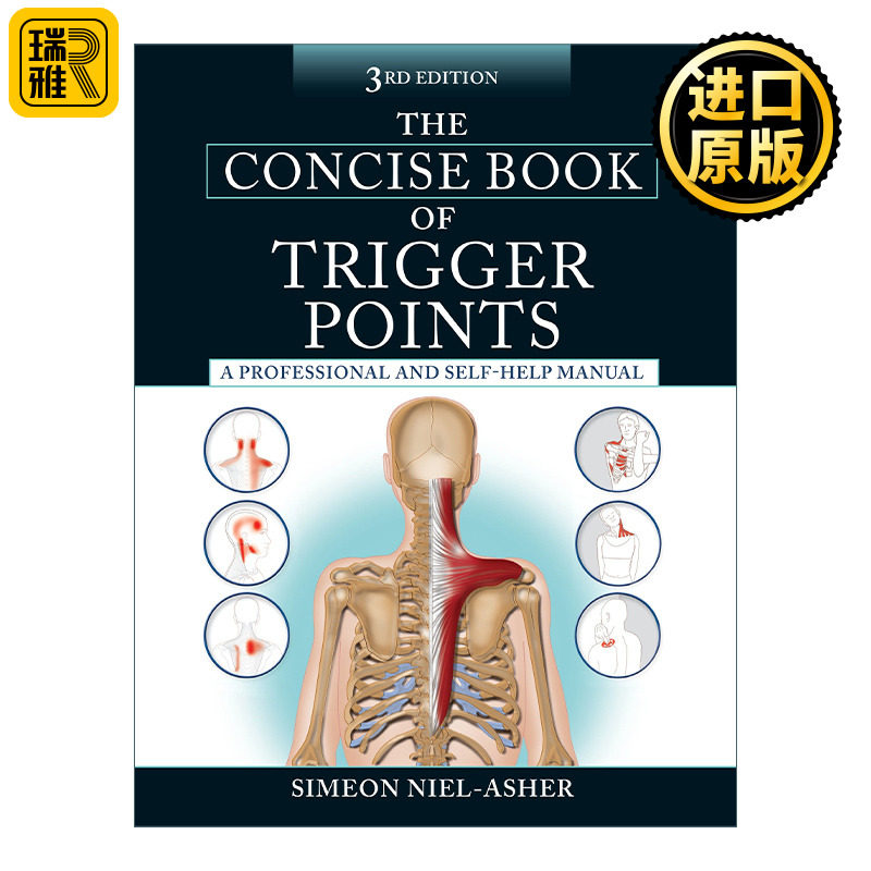 The Concise Book of Trigger Points  英文原版