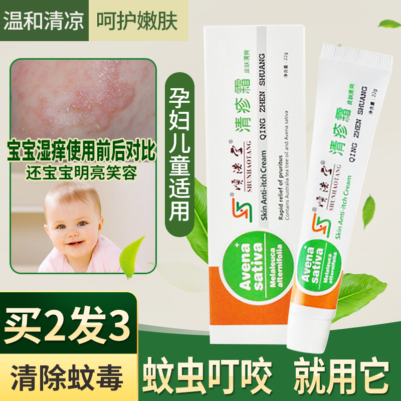 儿童溼疹婴宝无激素蚊虫叮咬止痒消肿膏宝宝婴儿皮肤抑菌止痒瘙痒