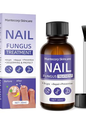 美国代购1Pcs 30Ml Toenail Fungus Treatment,Nail Fungus Treat