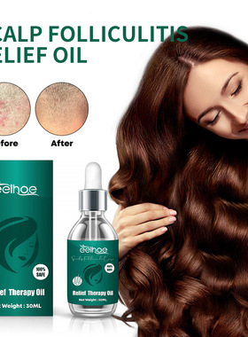 EELHOE 头皮护理精华 深层清洁毛囊头皮屑修护头发柔顺护理精华