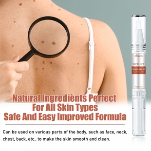 Ximonth 克尤液笔 皮肤标签清洁去除肉粒鸡眼扁平尤黑痣平滑肌肤